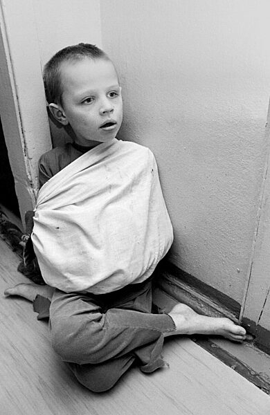 Consequences of the Chernobyl disaster: disabled children