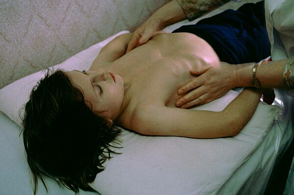 Consequences of the Chernobyl disaster: Children's sanatorium (1994)