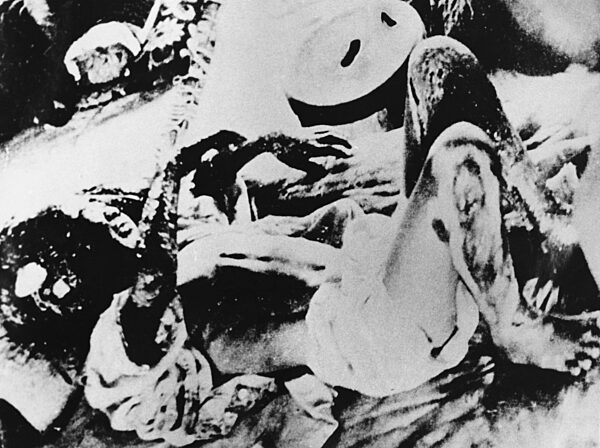 Verletzter in Hiroshima, 1945