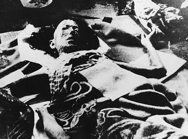 Verletzter in Hiroshima, 1945