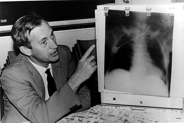 Miracle heart transplant