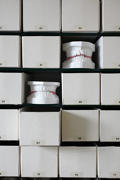 Germany, Bavaria, orthodontia, plaster casts, sets of teeth