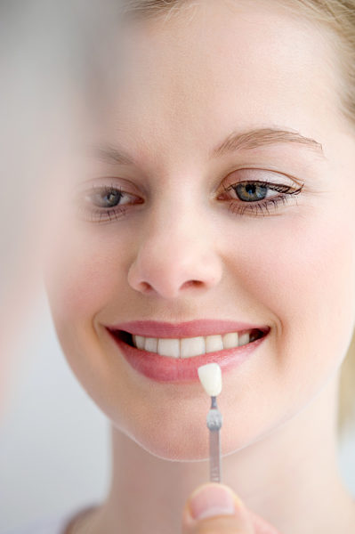 Woman with tooth veneer