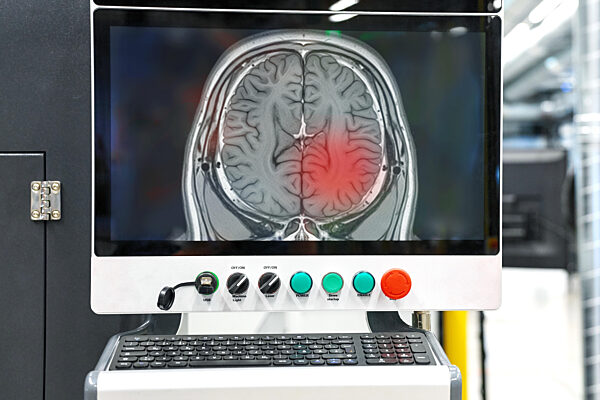 Fotomontage, Auf einem Monitor ist ein MRT-Bild des Gehirns mit rot markierter Auffälligkeit zu sehen, die auf einen möglichen Hirntumor hinweist. Moderne Bildgebung unterstützt Neurologie und Onkologie bei Diagnose und Therapieplanung. Digital nachbear