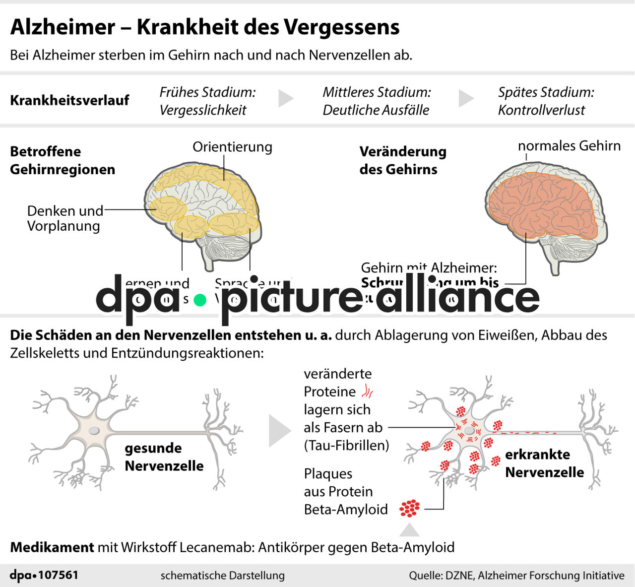 Alzheimer - Krankheit des Vergessens (23.01.2026)