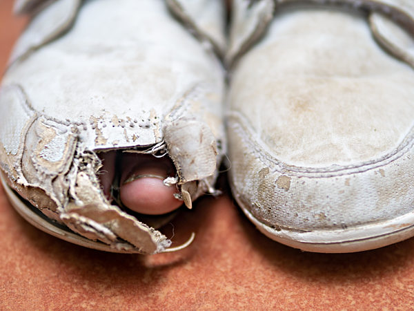 Zeh schaut aus kaputtem Sportschuh