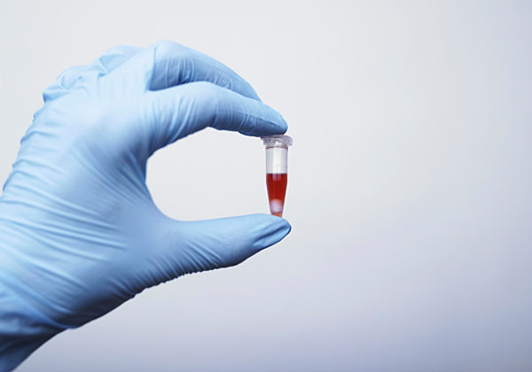 Forensik, Hand mit Blutprobe