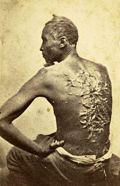 Carte-de-visite of a formerly enslaved man identified only as Private Gordon. Gordon is seated, wearing pants and no shirt. Facing the camera is his bare back, which is covered with heavy, raised scars from just above the shoulder blades to his lower back,
