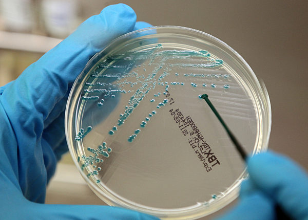 EHEC-Welle breitet sich aus - Labor